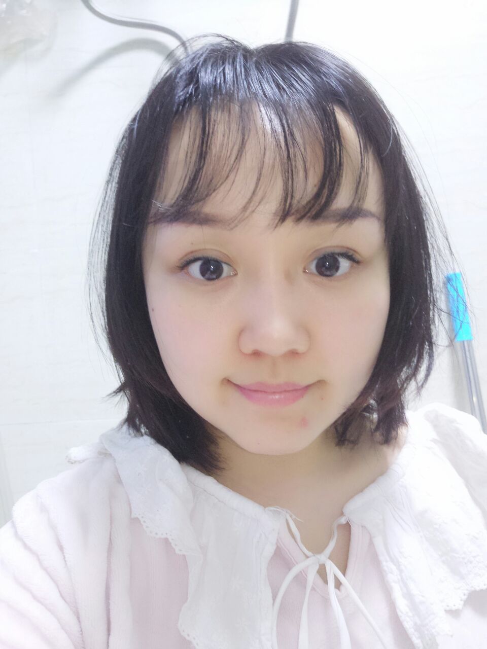 纯素颜,连姨妈痘都在,做过硅胶隆鼻和全切双眼皮,双_圈子-新氧美容