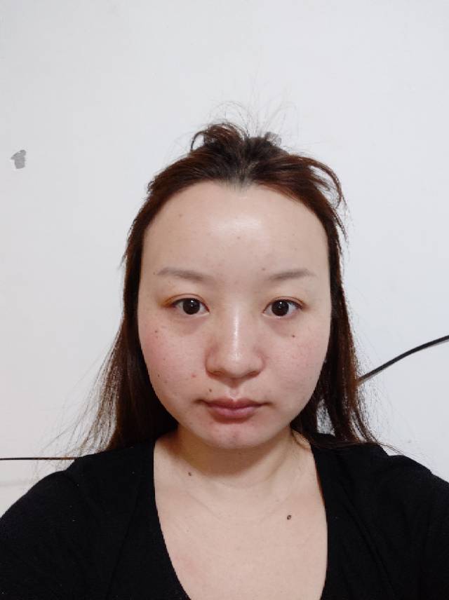 真的很需要勇气发这么丑的素颜照啊,感觉满屏幕都是自_圈子-新氧美容