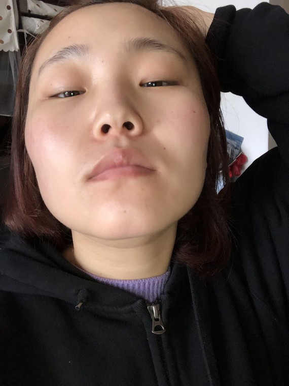 除了自己胖之外,觉得自己的眼睛又小又狭长,有点内双,眼睛怎么变大一