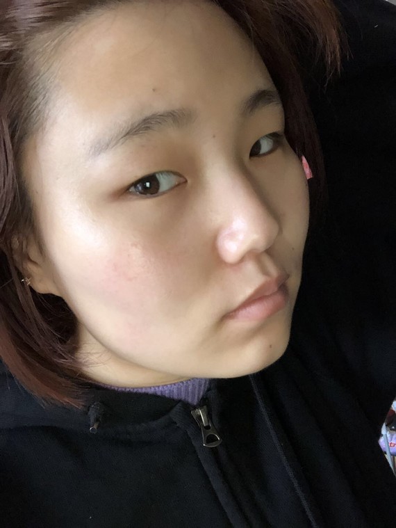 除了自己胖之外,觉得自己的眼睛又小又狭长,有点内双,眼睛怎么变大一