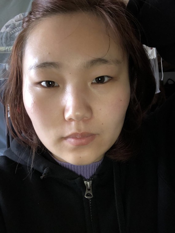 除了自己胖之外,觉得自己的眼睛又小又狭长,有点内双,眼睛怎么变大一