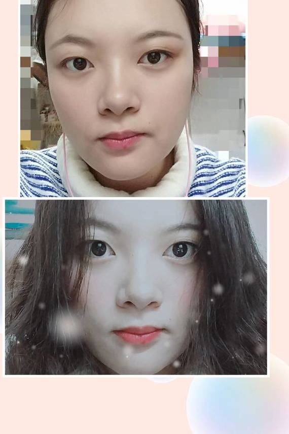 美商认知:宽眼距=怪女孩?