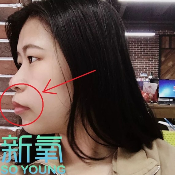 问题的同时还可以改善妹子嘴角下垂的情况,人中偏长也可以有所缓解呐!