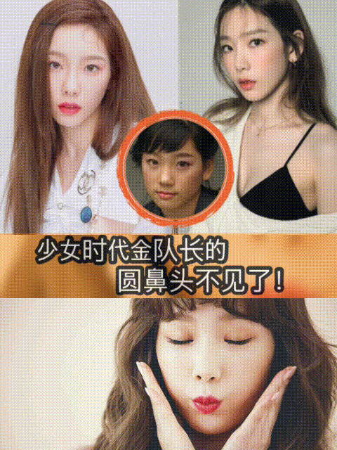 韩国女团少女时代的队长 金泰妍 4月6日下 圈子 新氧美容整形