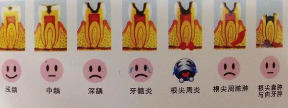 所以大家如果发现自己牙齿有问题,一定要及时检查,及时就医,趁还没有