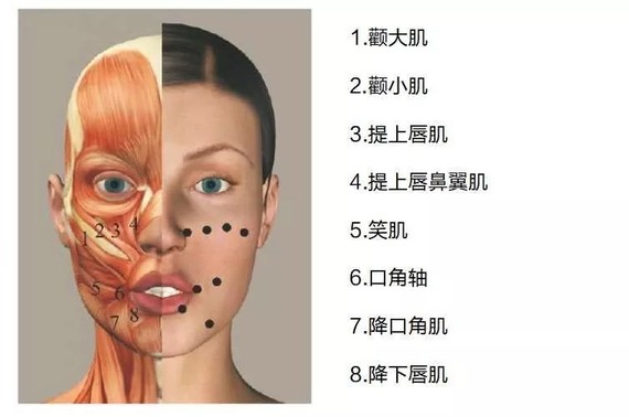 首先在表情自然状态下于健侧颊肌处标出注射点,标记方法以估测双侧