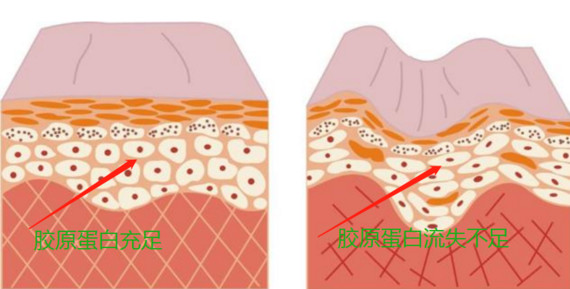 胶原蛋白 胶原蛋白口服液有用吗
