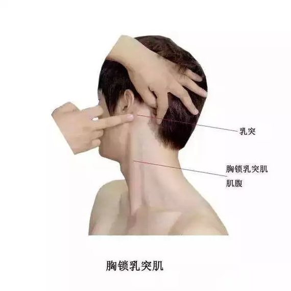 如果胸骨(左图)部分出现问题,就会导致一些筋膜肌痛点,这些肌痛点会