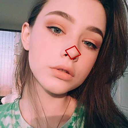 受到审美偏好的影响,亚洲多修出球形鼻头,欧美则对应盒型.