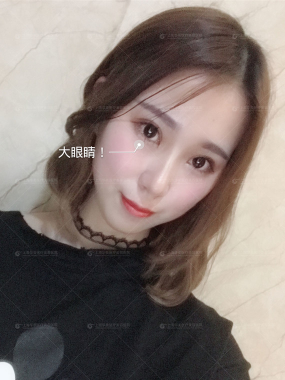 目眦欲裂、三白眼太吓人,谈谈大眼这件事我