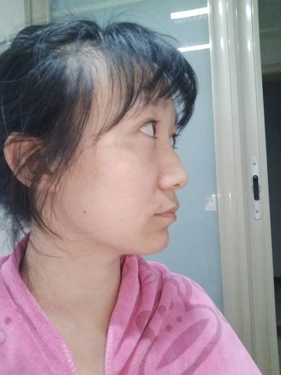 新氧看脸天团#我觉得我额头大鼻子宽下巴短中庭长眼_圈子-新氧美容