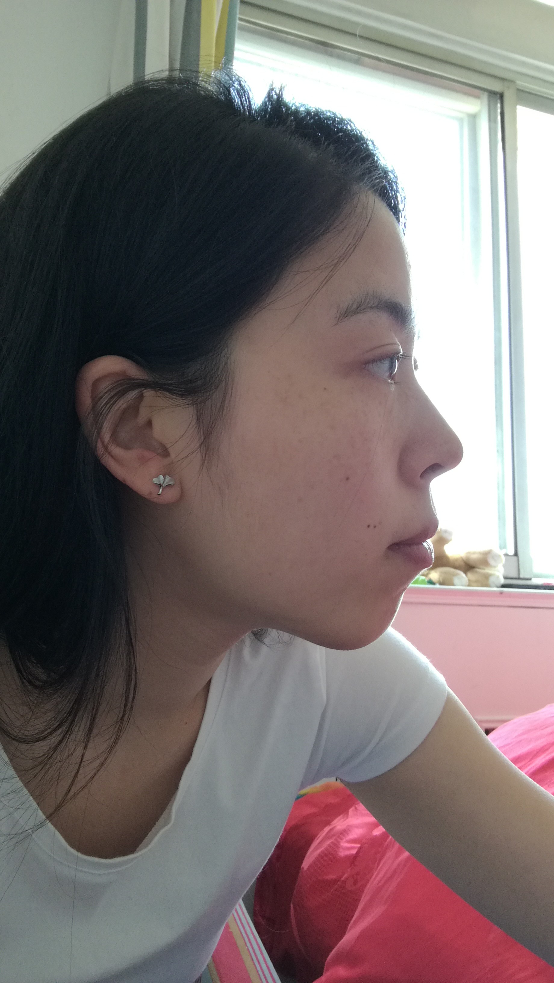 高中时候做过正畸,但是好像没做太好,牙弓做的太窄了_圈子-新氧美容