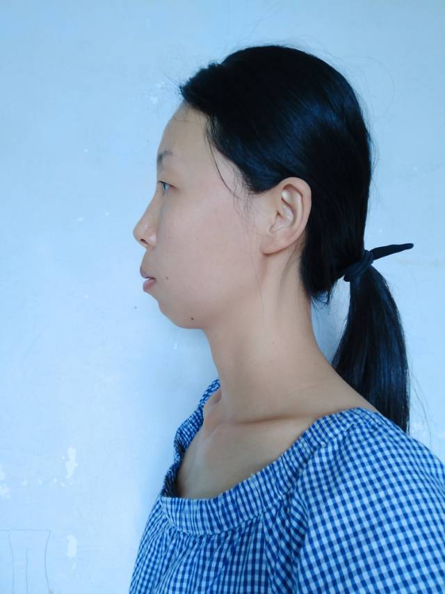 嘴突没下巴,眼睛小颧骨突.艾玛~我是需要换头么 @迷思氧