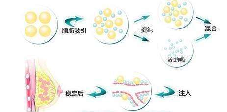 首页 此页面仅支持预览 Avatar 氧气 4e543 篇日记 胸部很小怎么办 的胸部可以通过隆胸手术来塑造 自体脂肪 丰胸可以快速有效的提升女性胸部大小 采用 脂肪搬家 的原理让该凸出的地方凸 该减平的地方减平 成功实现丰胸美体的目的 那么自体脂肪
