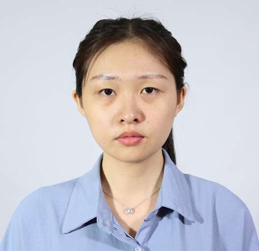 术前眼部状态:内双,眼裂短,双眼不对称,眼睛无神.