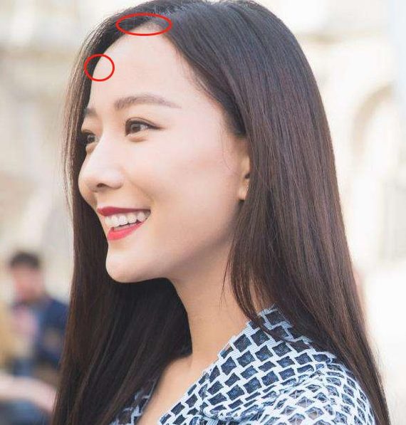 4指 最终由额丘,颞线,眉弓等骨性凸起 发际线,组合成了我们的额头形状