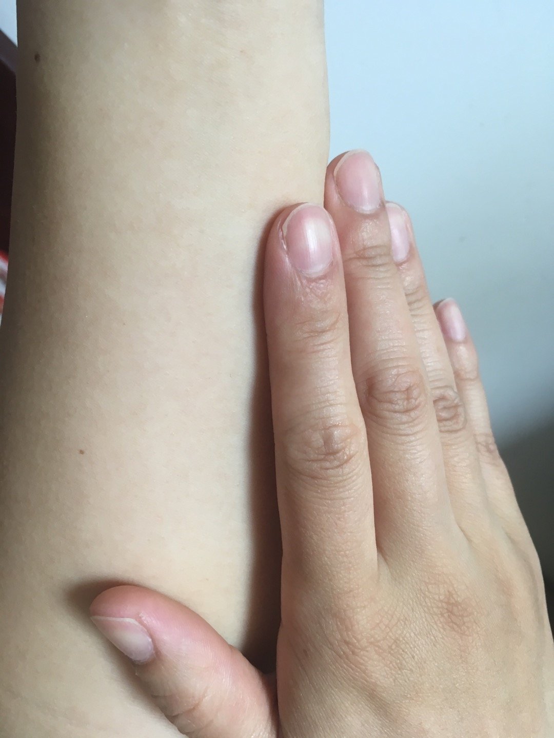 刚入夏去练车,结果手就被晒黑了,唉.第3张照片是我_圈子-新氧美容整形