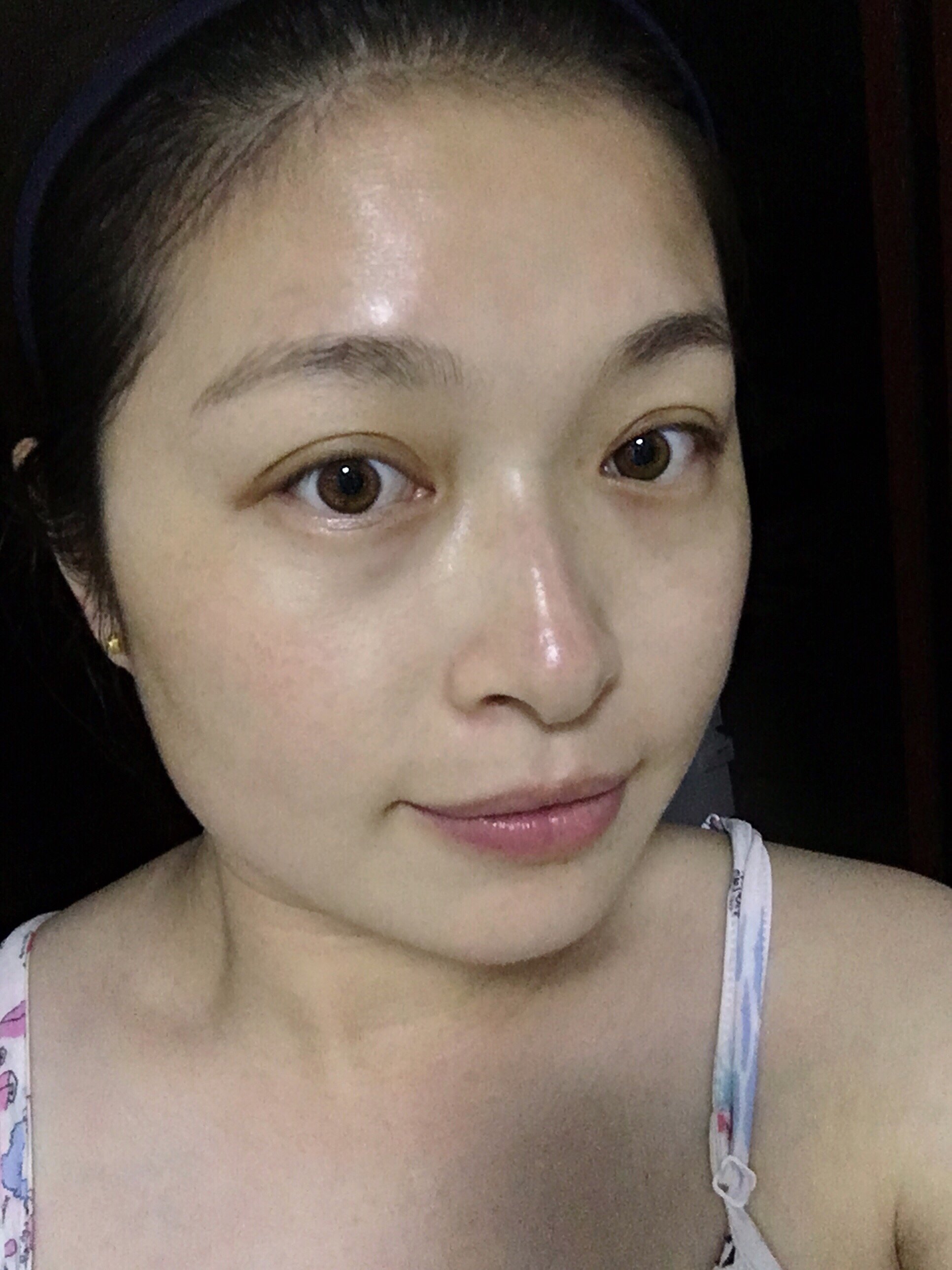 31岁的孩儿她妈久违的撸了一个面膜,但是苹果的前置_圈子-新氧美容