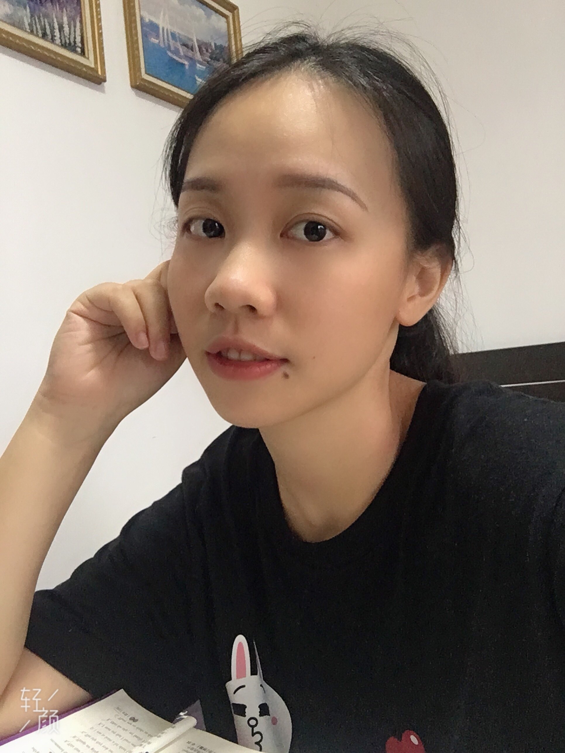 传说中的贪吃痣所以我胖是有原因的