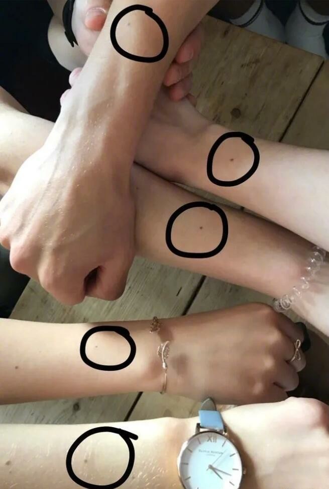听说每个人的胳膊上都有一个痣
