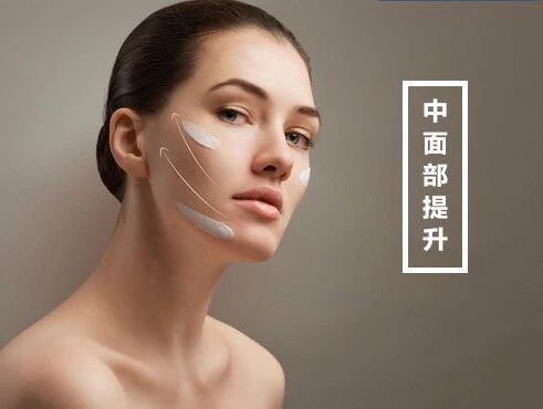 解决嘴角嘟嘟肉和面颊部分的提升方法有的女孩子刚二十 圈子 新氧美容整形