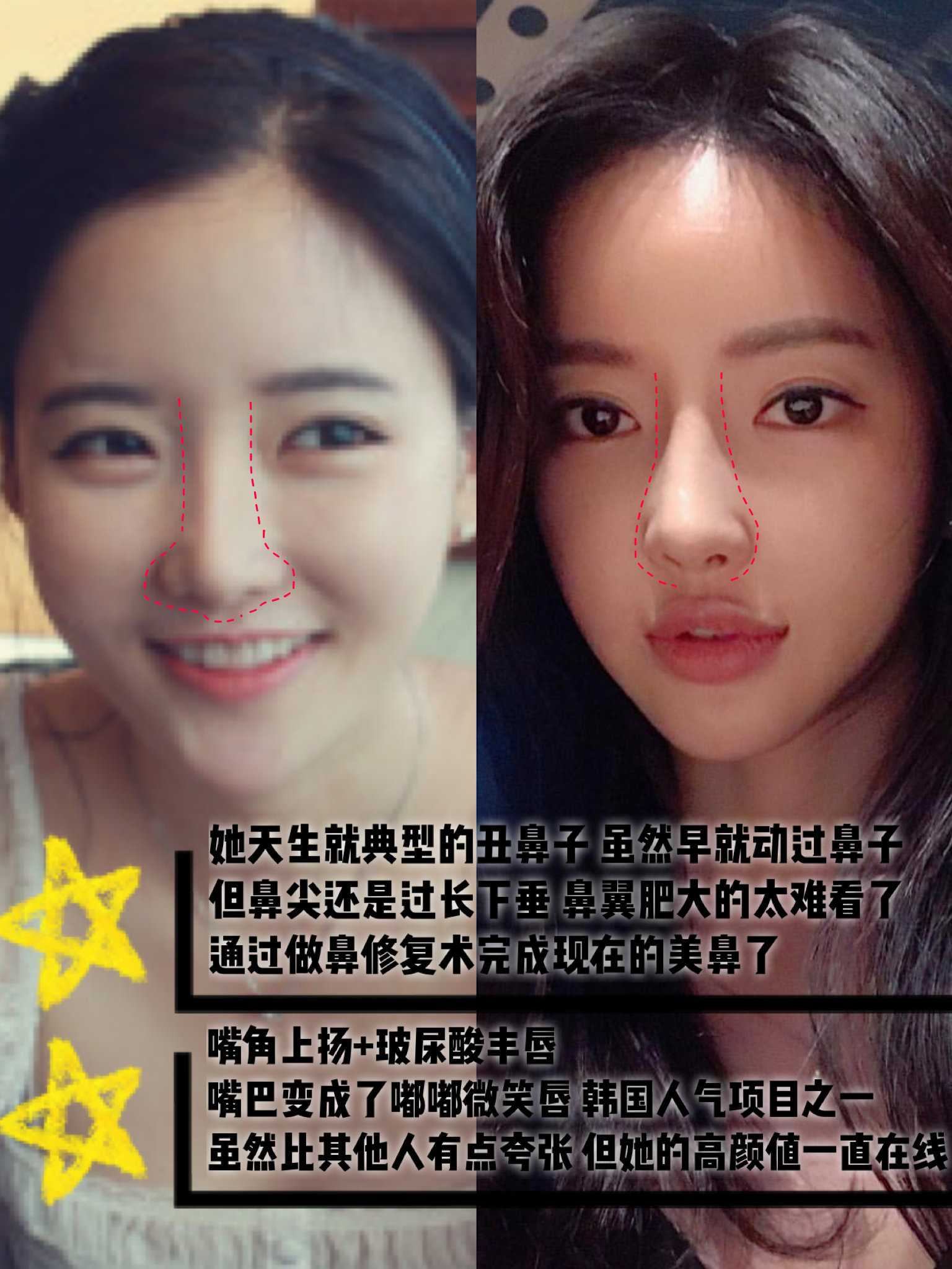 原来潘南奎这么成为女神整过不止一次?