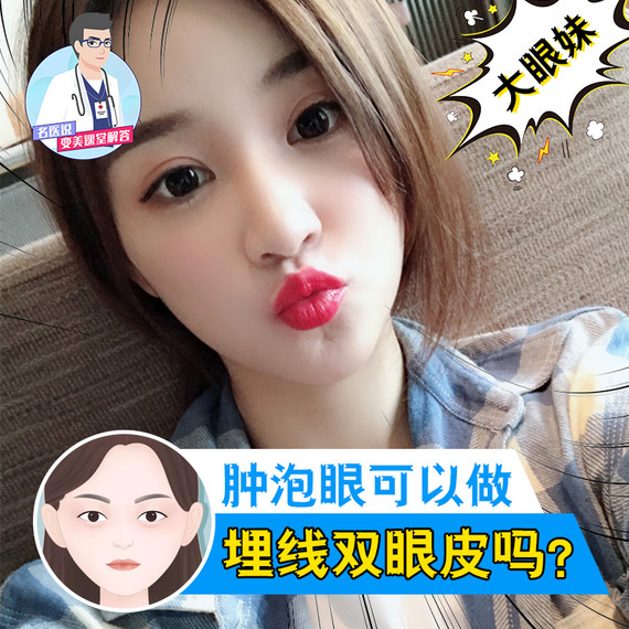 肿泡眼可以做埋线双眼皮吗