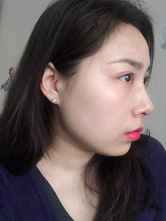 新氧一直觉得我嘴有点凸,除了胖带来的轮廓不清晰,还哪里有问题呀?