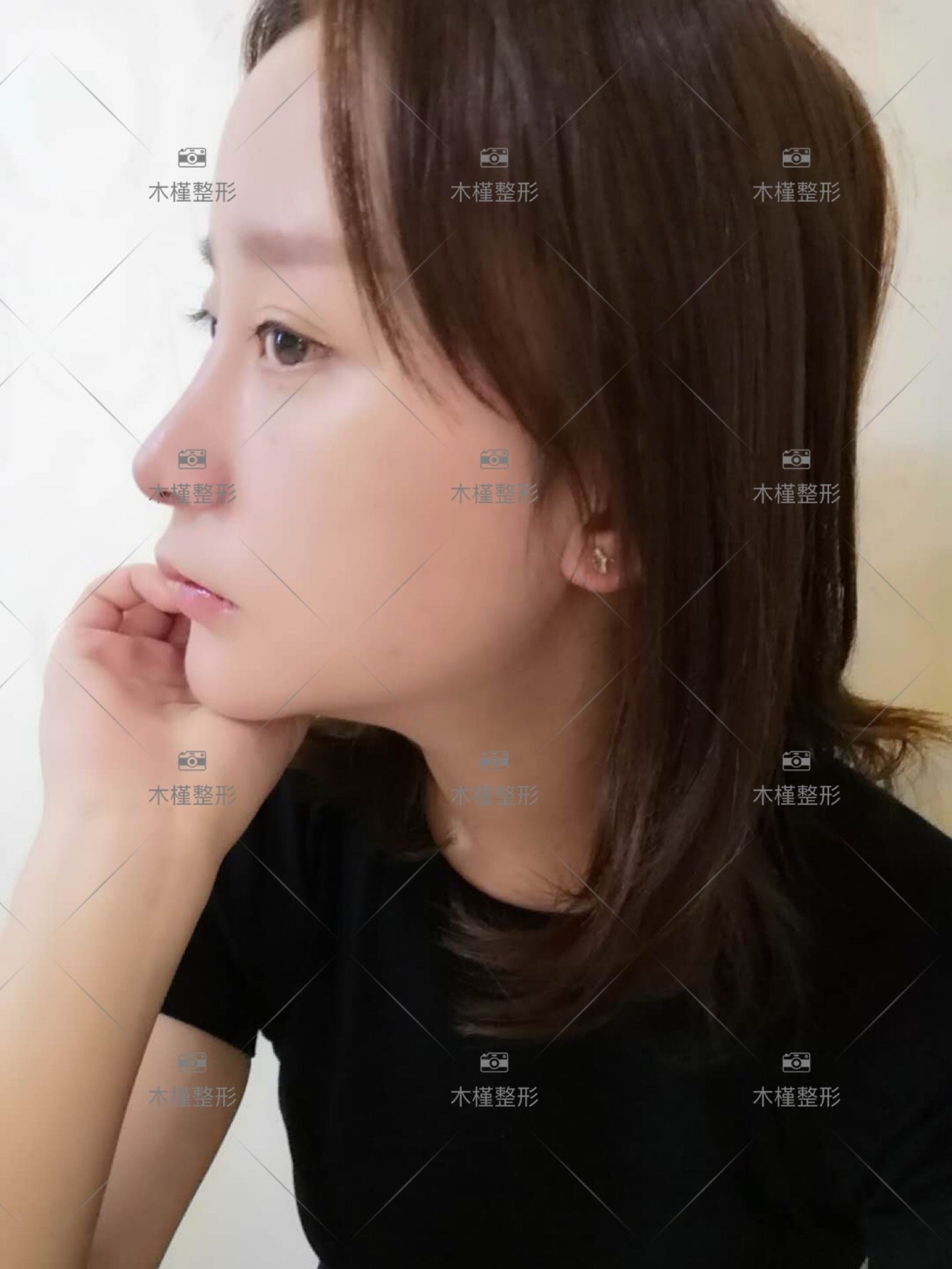 首先来说_圈子-新氧美容整形