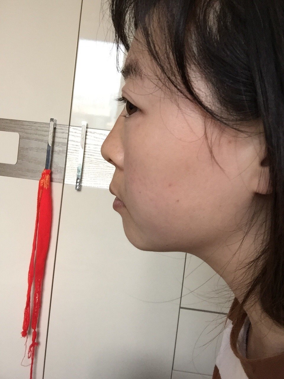 迷死氧,痒,侧面鼻子需要怎么动下?感觉鼻梁低,露_圈子-新氧美容整形