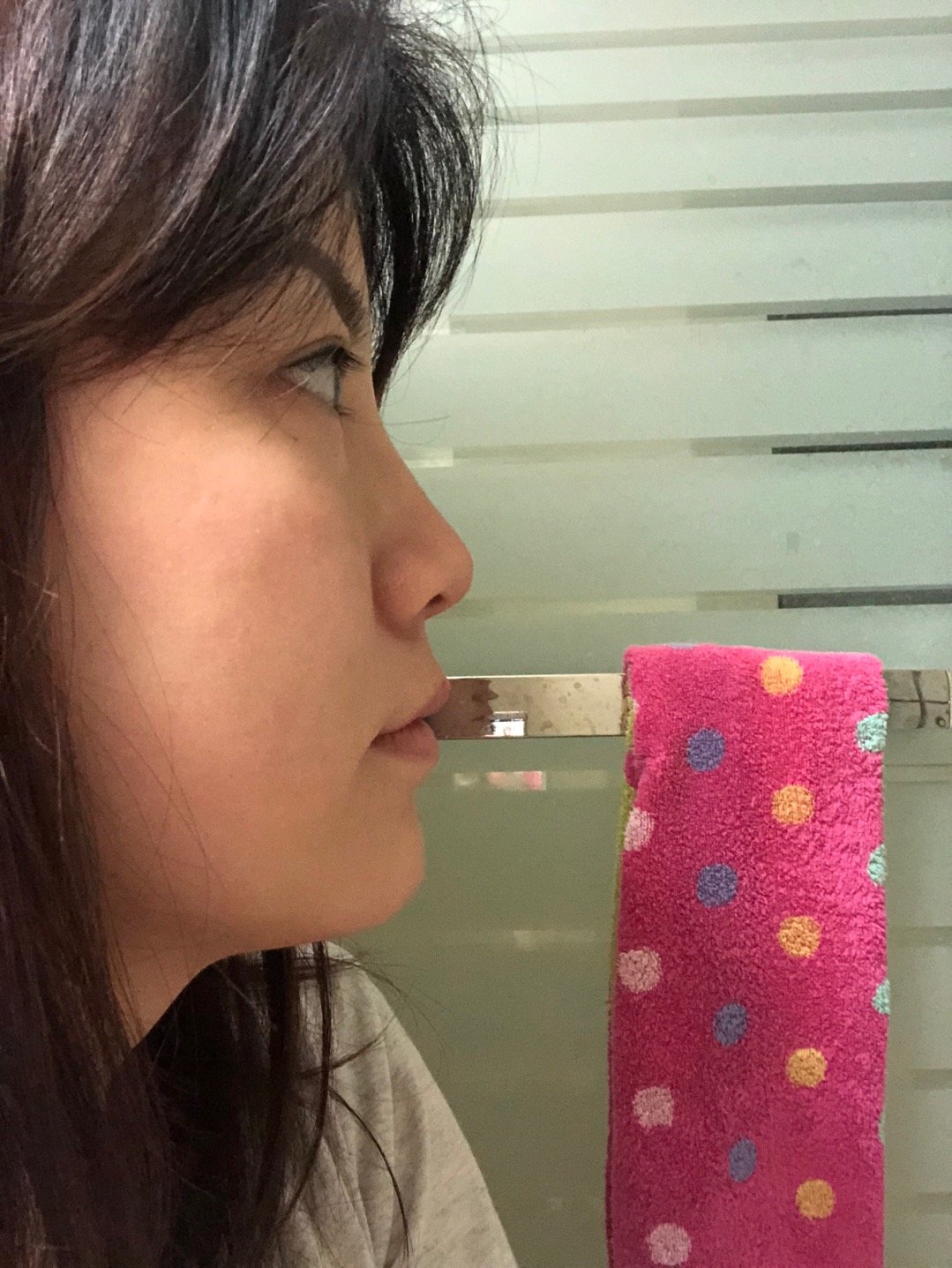 求被选中山根挺好的但始终觉得不够饱满自己推测就是鼻_圈子-新氧美容