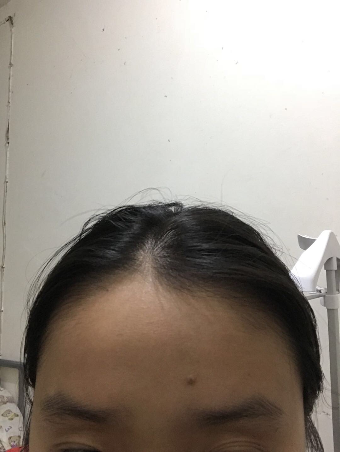 比欧阳娜娜还惨……我该怎么办,额头太高显得鼻子更塌