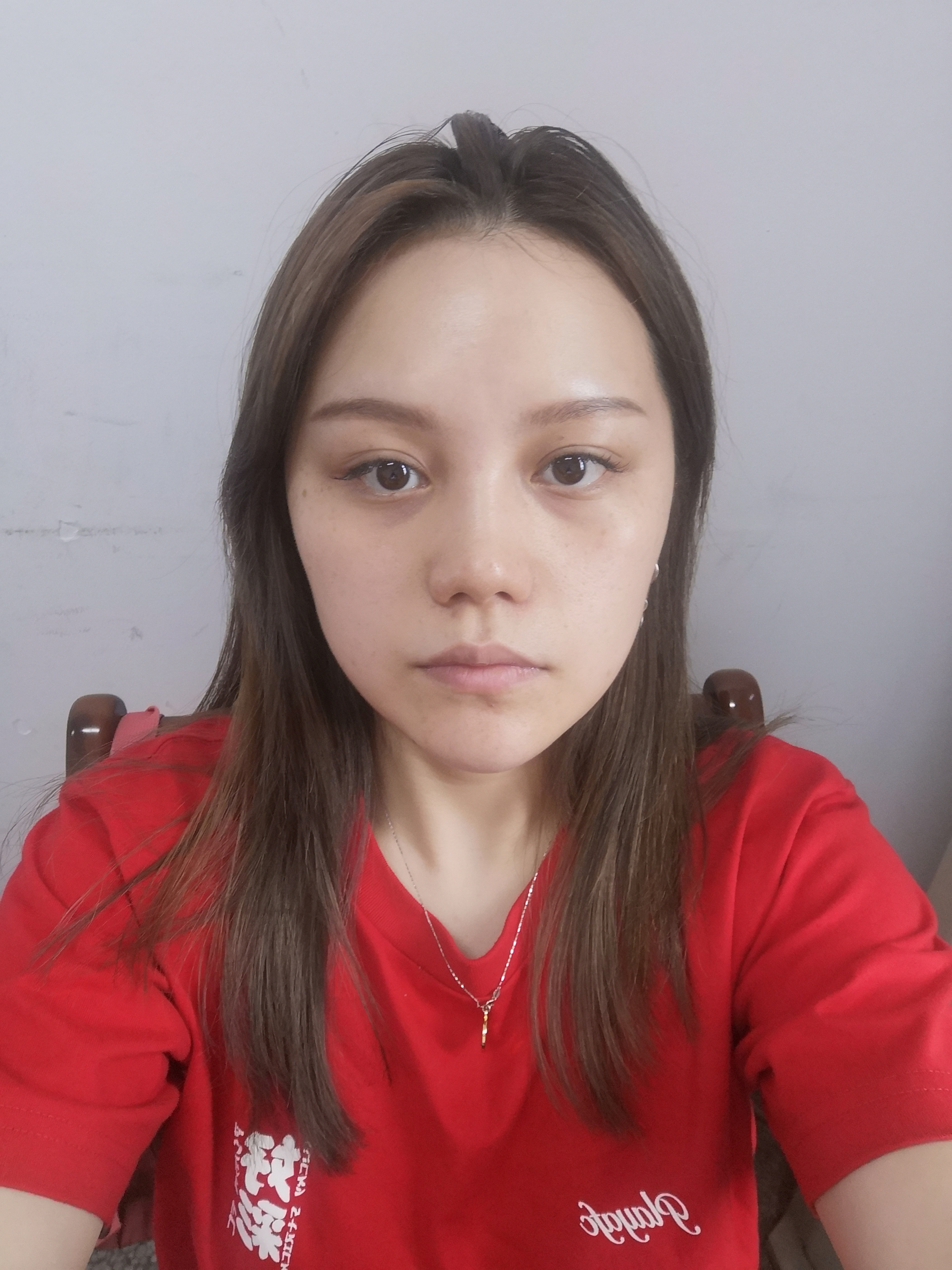 素颜照就显得整个很疲倦没精神,平时老熬夜.想问下_圈子-新氧美容整形