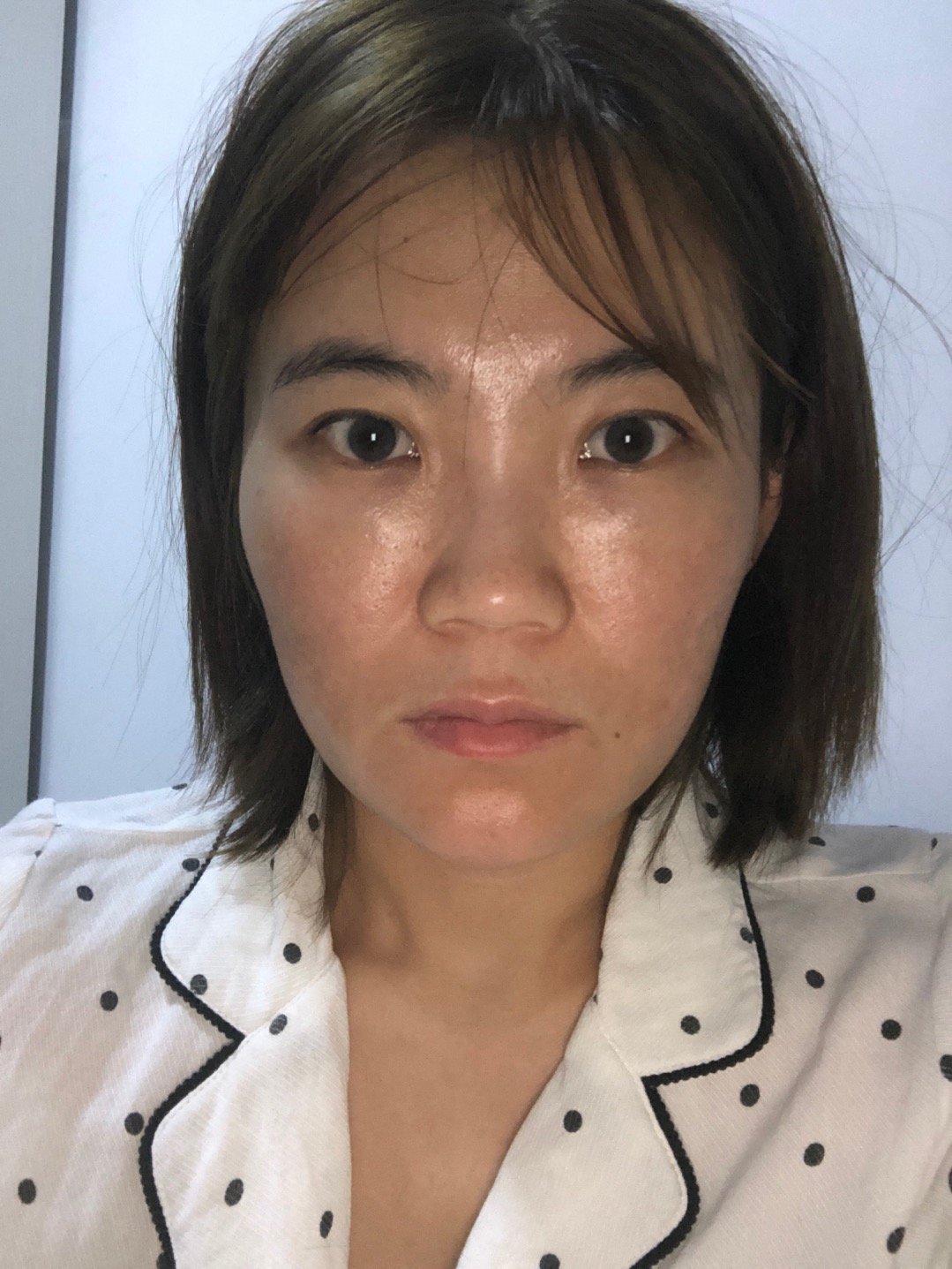 普通人中最普通的人面部比较宽颧骨宽鼻梁塌脸颊还有嘟_圈子-新氧美容