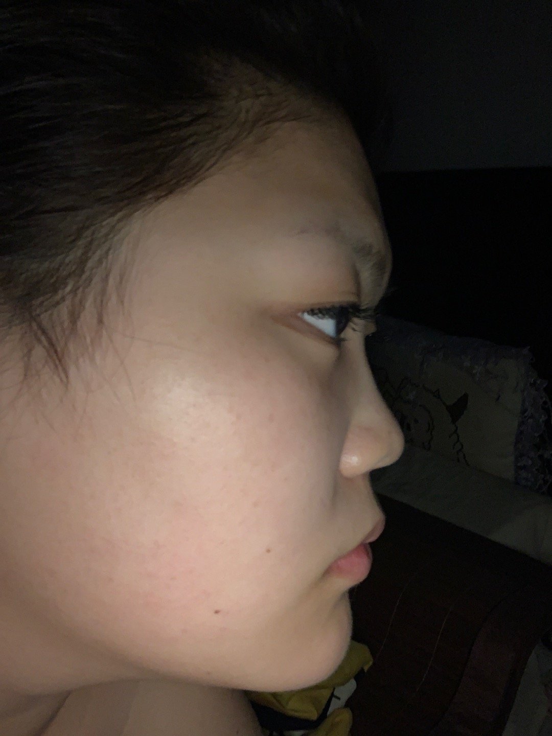 面中凹鼻子小且塌眼皮塌眼球凸额头低颧骨宽嘴凸