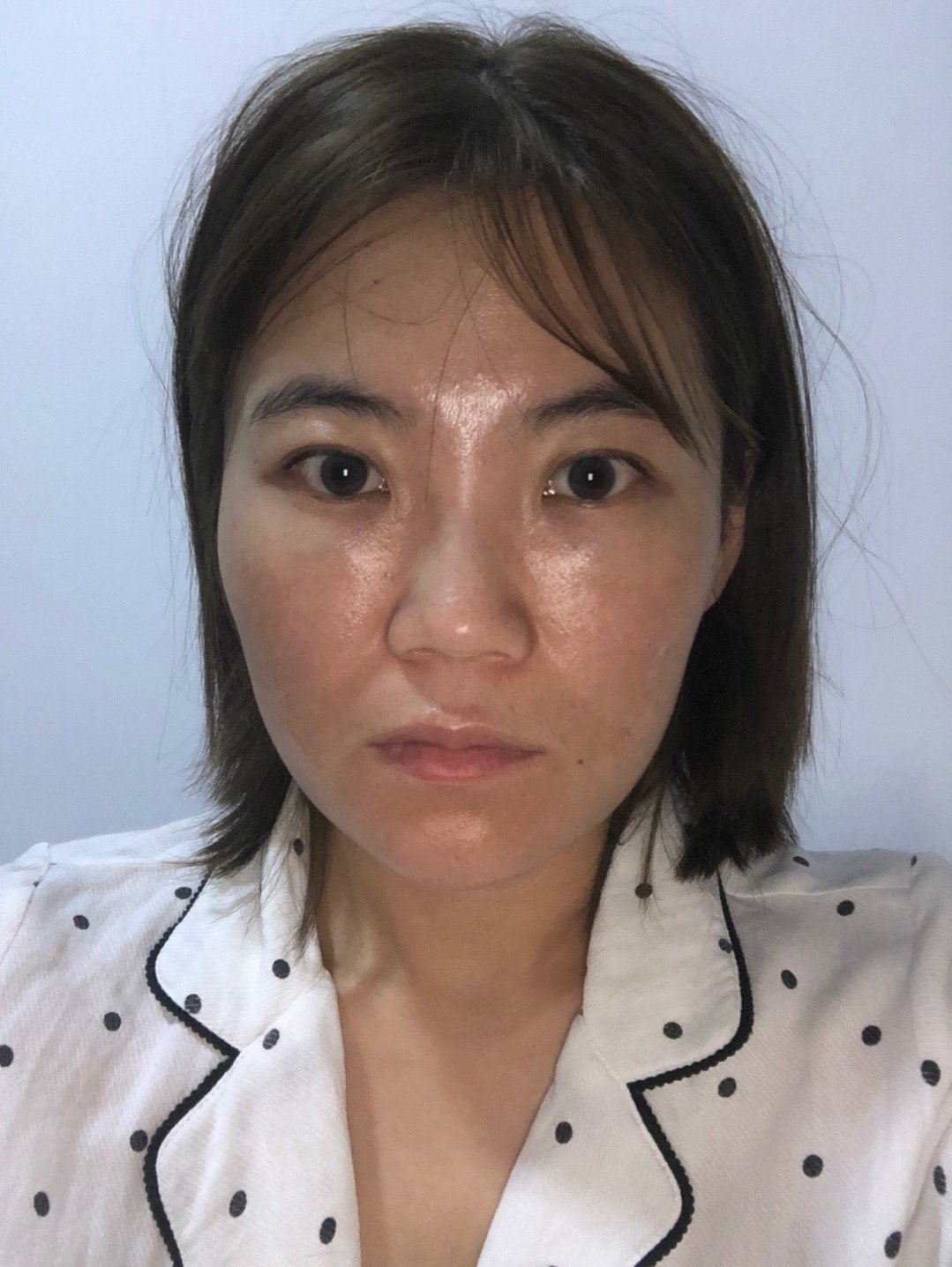 普通人中最普通的人面部比较宽颧骨宽鼻梁塌脸颊还有嘟_圈子-新氧美容