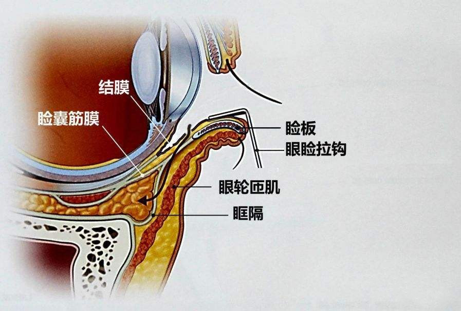 真不敢相信,这个后果竟是自己一手造成的!