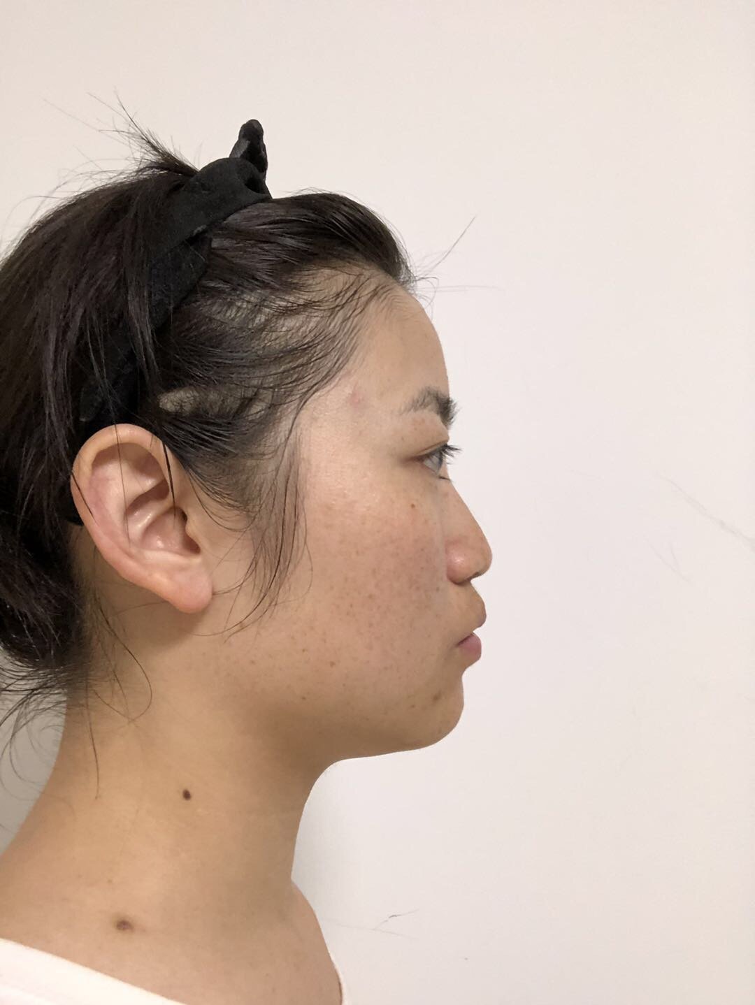 0707两边脸不对称,龅牙嘴凸,正脸看鼻子91还是斜的01_圈子