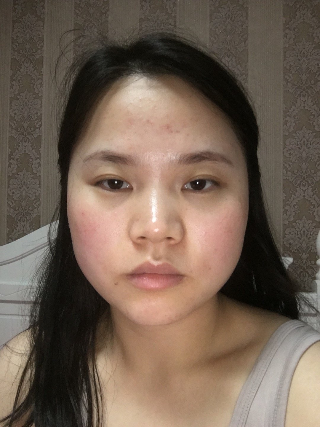 大小眼,而且两边脸不对称,下颌角宽大,颧骨也大,希_圈子-新氧美容整形