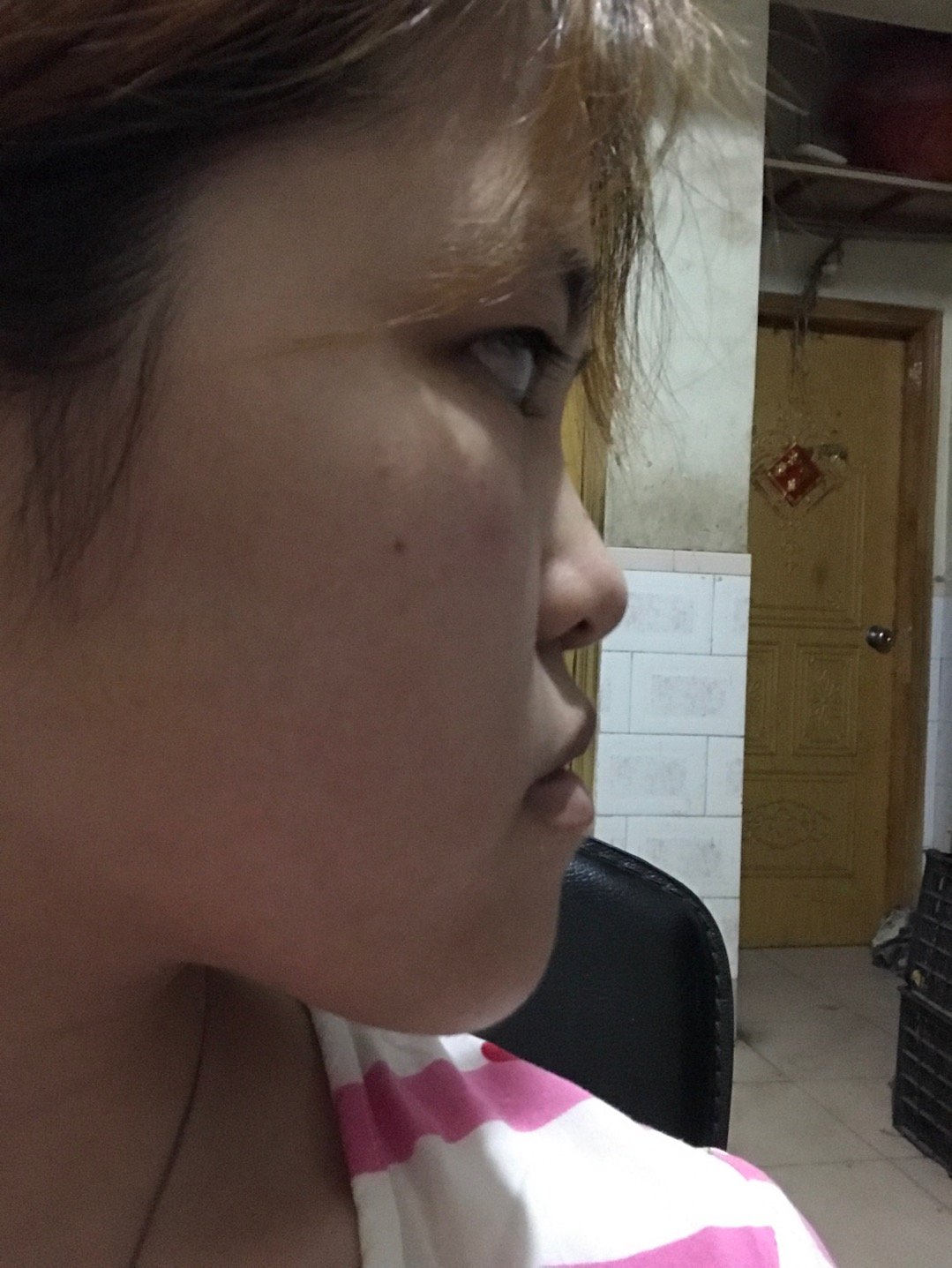 感觉自己脸上bug真的超级多,,,什么山根低啊地包天鼻基底低什么的真的