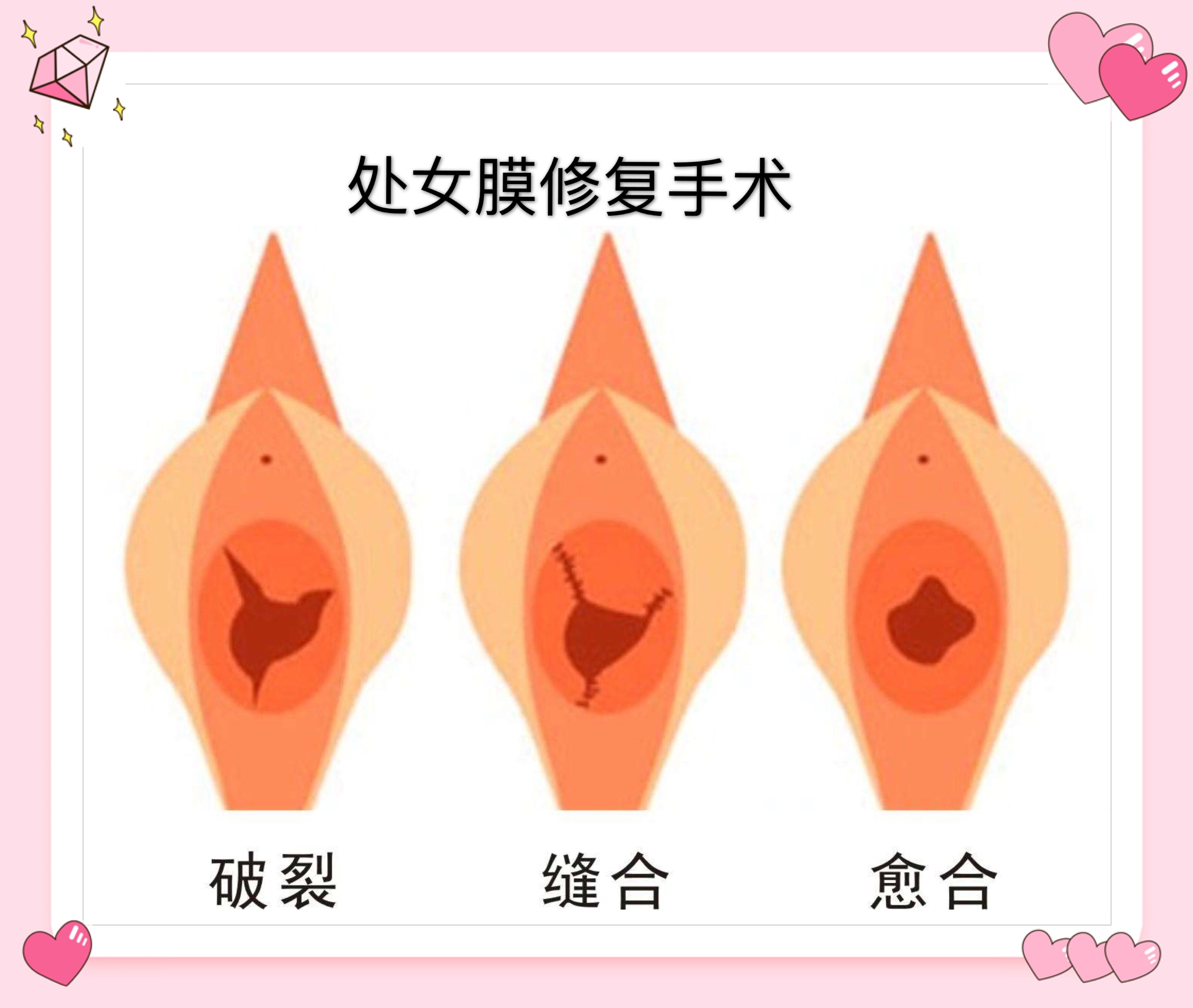 处女膜破了那晚男友做了三次留了很多血如果以后经常和男友一起做的话