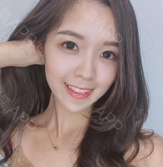 牙髓炎需要做根管治疗吗牙髓炎相信大家都不陌