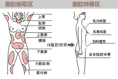 我胸太小了 可以把肚子上的赘肉填到胸 新氧美容整形