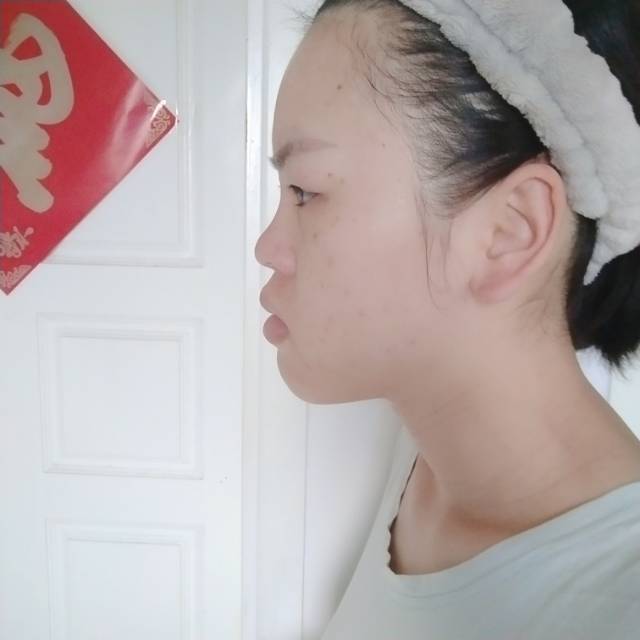 颜值困扰:有点凸嘴脸偏长五官不立体 没有山根