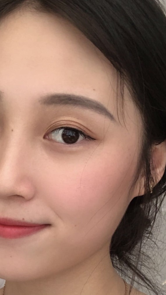 一只三层眼皮一只四层眼皮.