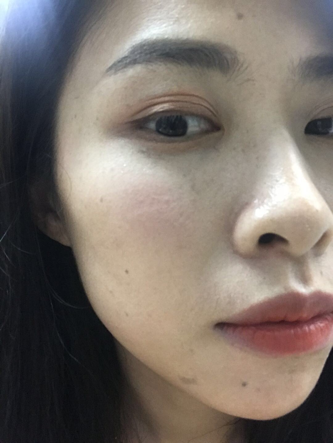 有一只三眼皮,经常被人质疑是不是割的