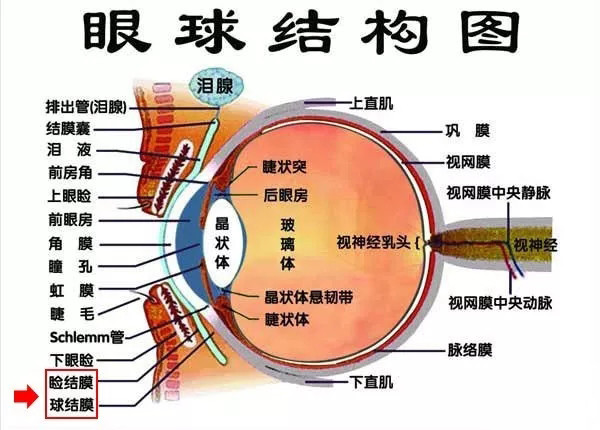 割双眼皮后眼睛充血了怎么办 新氧美容整形