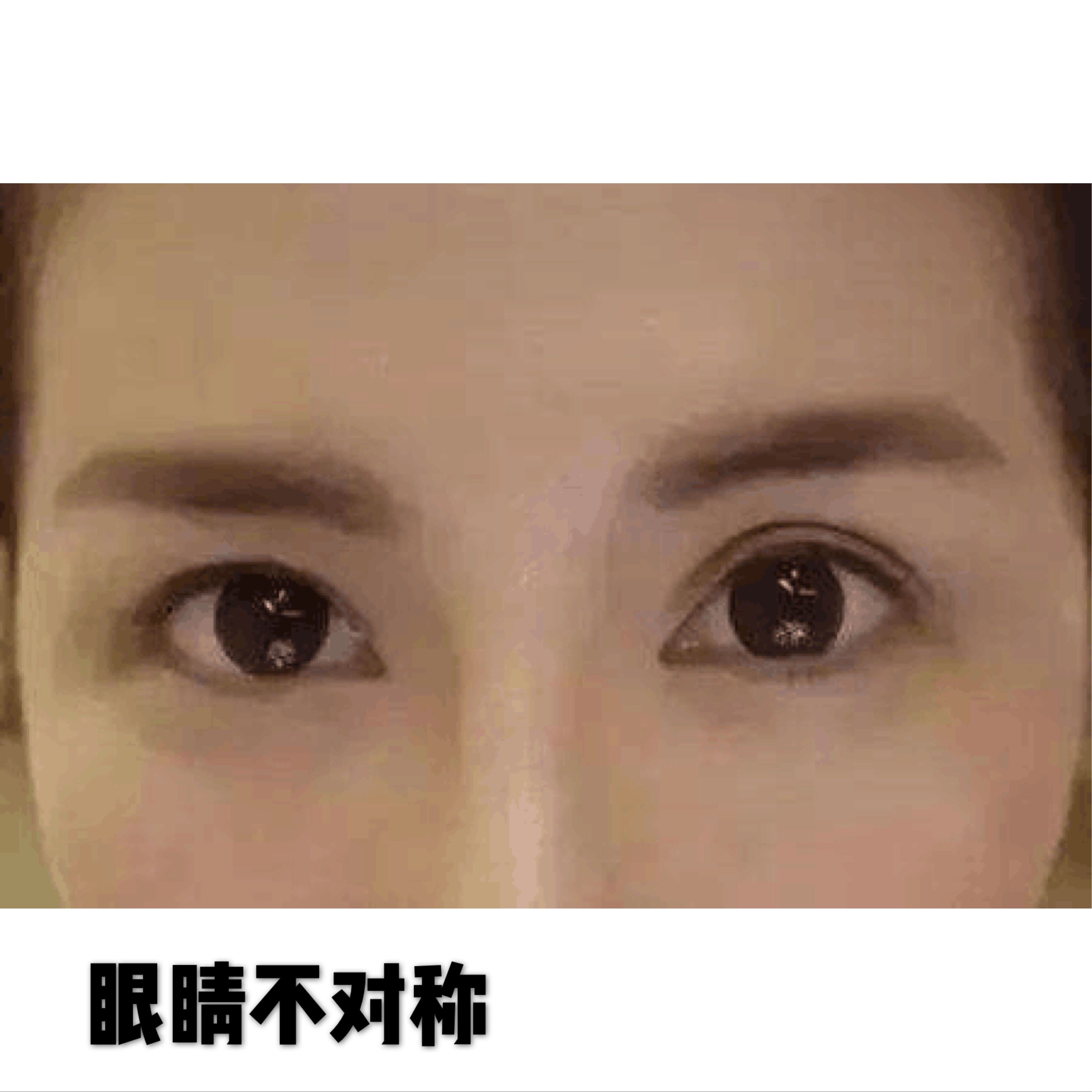 天然双眼皮和割的双眼皮有什么区别?