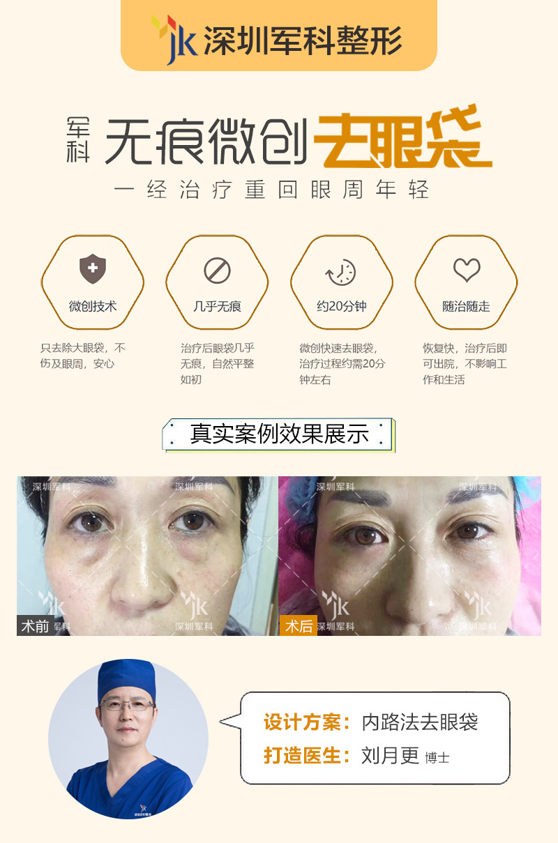 眶隔脂肪去眼袋是什么原理 黄金微针可 新氧 专业医美服务平台