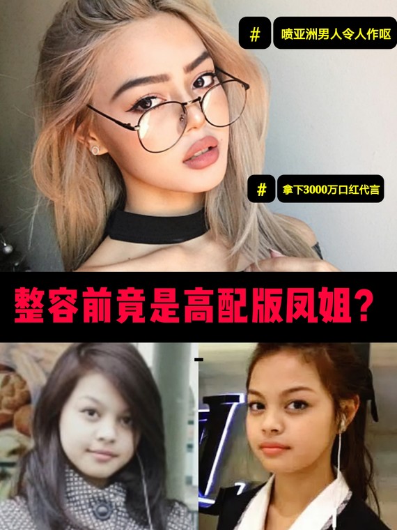 狂喷亚洲男人称令人作呕 拿下3000万口红代言费的 圈子 新氧美容整形